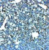 Anti-LRRC8A antibody used in IHC (Paraffin sections) (IHC-P). GTX31953