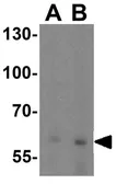 Anti-SLC38A4 antibody used in Western Blot (WB). GTX31954