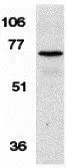 Anti-CNKSR1 antibody used in Western Blot (WB). GTX31960