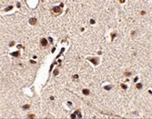 Anti-MEX3A antibody used in IHC (Paraffin sections) (IHC-P). GTX31965