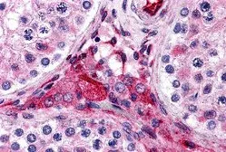 Anti-PTCHD2 antibody used in IHC (Paraffin sections) (IHC-P). GTX31967