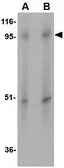 Anti-SLC39A10 antibody used in Western Blot (WB). GTX31968