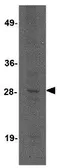 Anti-KLRA3 antibody used in Western Blot (WB). GTX31969
