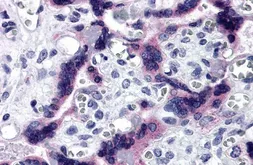 Anti-TTBK2 antibody used in IHC (Paraffin sections) (IHC-P). GTX31971