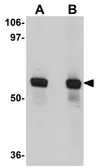 Anti-SRPX2 antibody used in Western Blot (WB). GTX31974