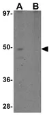 Anti-RHBDD1 antibody used in Western Blot (WB). GTX31979