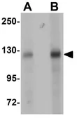 Anti-BCAS3 antibody used in Western Blot (WB). GTX31983