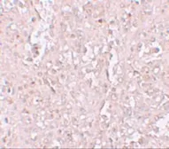 Anti-SLC39A13 antibody used in IHC (Paraffin sections) (IHC-P). GTX31995