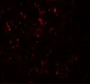 Anti-SLC39A14 antibody used in IHC (Paraffin sections) (IHC-P). GTX31996