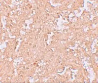 Anti-ZBTB8 antibody used in IHC (Paraffin sections) (IHC-P). GTX31999