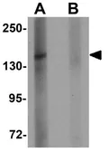 Anti-ZMYM1 antibody used in Western Blot (WB). GTX32000