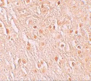 Anti-PION antibody used in IHC (Paraffin sections) (IHC-P). GTX32001