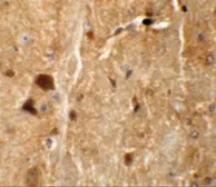 Anti-TMEM192 antibody used in IHC (Paraffin sections) (IHC-P). GTX32008