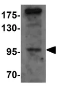 Anti-SIK2 antibody used in Western Blot (WB). GTX32010