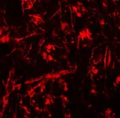 Anti-ORMDL1 antibody used in IHC (Paraffin sections) (IHC-P). GTX32012