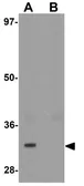 Anti-TYW3 antibody used in Western Blot (WB). GTX32016