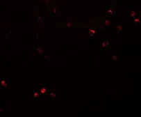 Anti-SPRYD3 antibody used in IHC (Paraffin sections) (IHC-P). GTX32022