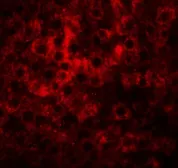 Anti-HDGFRP2 antibody used in IHC (Paraffin sections) (IHC-P). GTX32024