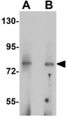 Anti-UHRF1BP1 antibody used in Western Blot (WB). GTX32029