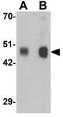 Anti-RILPL1 antibody used in Western Blot (WB). GTX32031