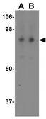 Anti-FCHSD1 antibody used in Western Blot (WB). GTX32034