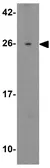 Anti-SPATA3 antibody used in Western Blot (WB). GTX32039