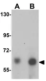 Anti-ANKLE1 antibody used in Western Blot (WB). GTX32043