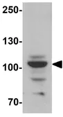Anti-Epac1 antibody used in Western Blot (WB). GTX32047