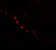 Anti-PTCHD2 antibody used in IHC (Paraffin sections) (IHC-P). GTX32048