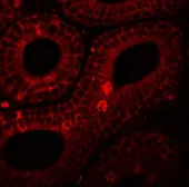Anti-SPINK2 antibody used in IHC (Paraffin sections) (IHC-P). GTX32051