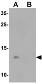Anti-YPEL5 antibody used in Western Blot (WB). GTX32065