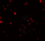 Anti-FAM193B antibody used in Immunocytochemistry/ Immunofluorescence (ICC/IF). GTX32081