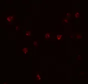 Anti-DDX60 antibody used in Immunocytochemistry/ Immunofluorescence (ICC/IF). GTX32082
