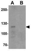 Anti-TCIRG1 antibody used in Western Blot (WB). GTX32087