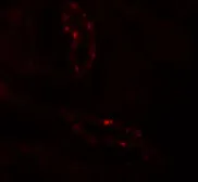 Anti-SCUBE3 antibody used in IHC (Paraffin sections) (IHC-P). GTX32089