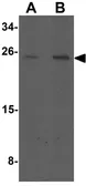Anti-MYCT1 antibody used in Western Blot (WB). GTX32092
