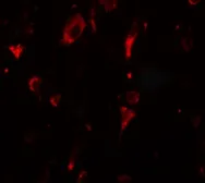 Anti-SGSM2 antibody used in IHC (Paraffin sections) (IHC-P). GTX32094