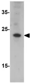 Anti-CHCHD6 antibody used in Western Blot (WB). GTX32100