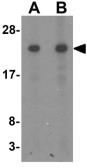Anti-GILZ antibody used in Western Blot (WB). GTX32107