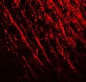 Anti-PRRT2 antibody used in IHC (Paraffin sections) (IHC-P). GTX32116