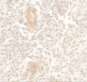 Anti-IL1F10 antibody used in IHC (Paraffin sections) (IHC-P). GTX32121