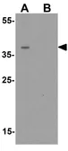 Anti-ZNF821 antibody used in Western Blot (WB). GTX32123