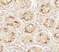 Anti-TMIGD2 antibody used in IHC (Paraffin sections) (IHC-P). GTX32127
