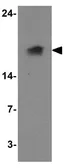 Anti-LAMTOR1 antibody used in Western Blot (WB). GTX32130