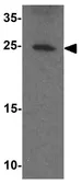 Anti-PDCL2 antibody used in Western Blot (WB). GTX32136