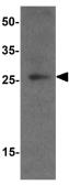 Anti-PDCL3 antibody used in Western Blot (WB). GTX32137