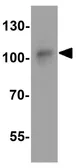 Anti-IQSEC1 antibody used in Western Blot (WB). GTX32142