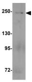 Anti-MYH3 antibody used in Western Blot (WB). GTX32147