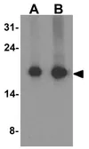 Anti-HOPX antibody used in Western Blot (WB). GTX32152