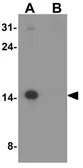 Anti-NAP1L5 antibody used in Western Blot (WB). GTX32154